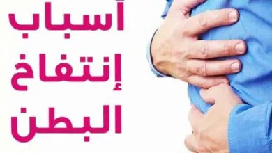 علاج الانتفاخات والغازات